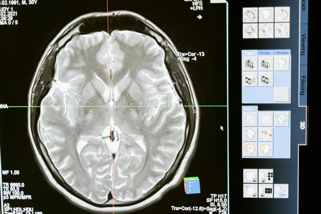 The Role of Psychometric Assessments in Career Planning