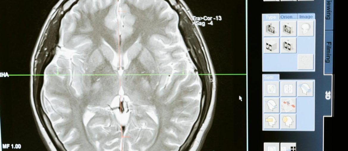 The Role of Psychometric Assessments in Career Planning