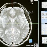 The Role of Psychometric Assessments in Career Planning