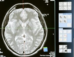 The Role of Psychometric Assessments in Career Planning