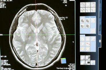 The Role of Psychometric Assessments in Career Planning